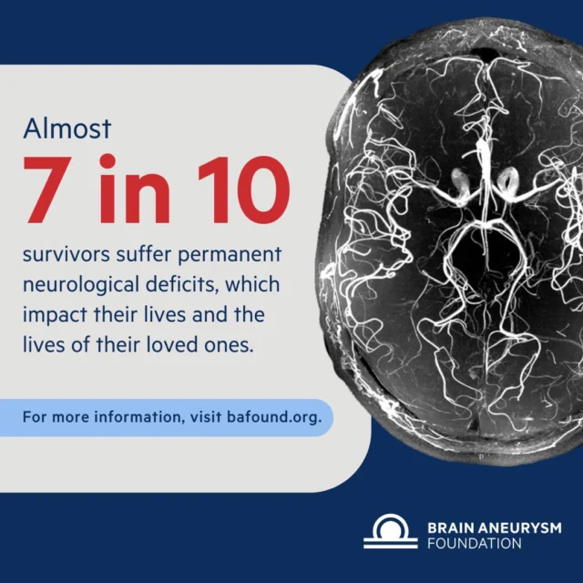 Almost 70% of survivors of a ruptured brain aneurysm suffer from long-term neurological impairments. Timely detection and ongoing support are crucial for improving outcomes and quality of life.
