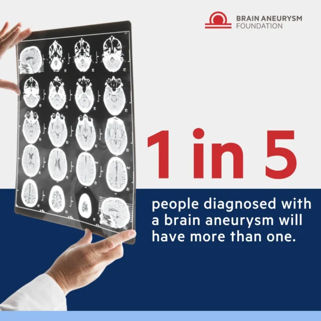 Approximately 20% of people diagnosed with a brain aneurysm have more than one. This statistic highlights the importance of thorough imaging and follow-up care after an initial diagnosis. Understanding your risk and staying informed can make a critical difference in outcomes.