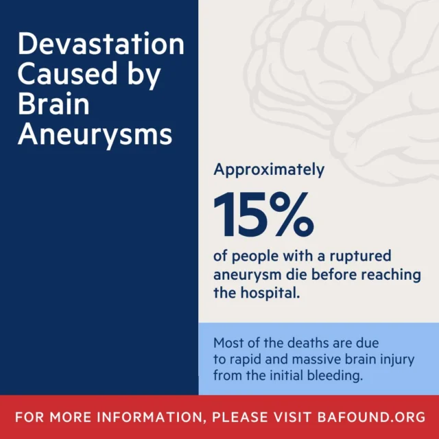 A brain aneurysm rupture is a medical emergency with devastating consequences. Around 15% of individuals do not survive long enough to receive hospital care, with most deaths occurring due to the immediate and severe brain damage caused by the initial bleeding.