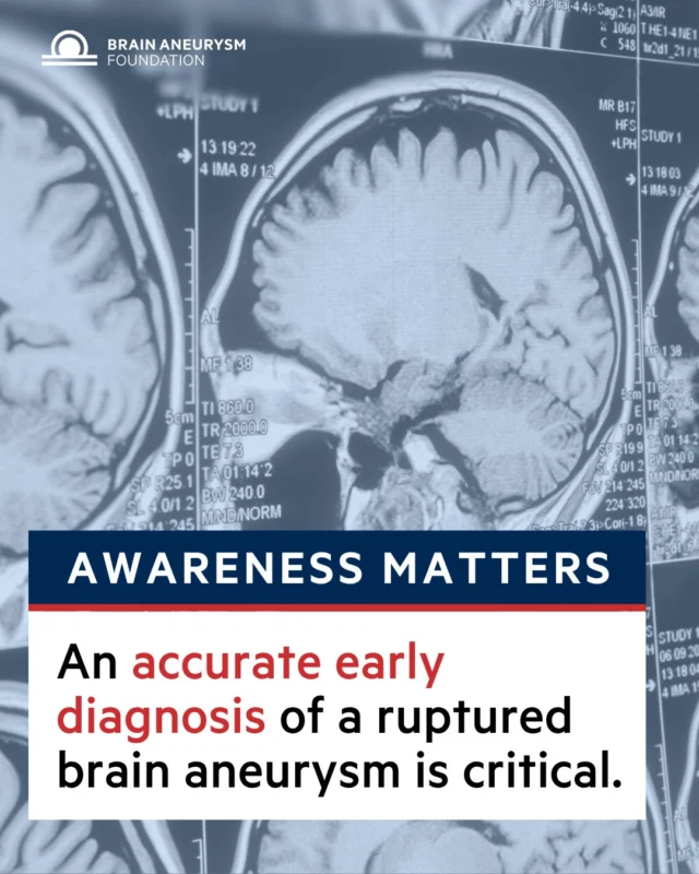 A brain aneurysm can rupture without warnin and every second counts.

An accurate early diagnosis can mean the difference between life and death. That’s why raising awareness is so important.