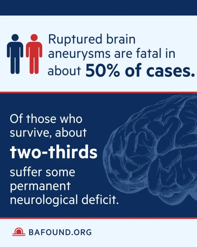 Ruptured brain aneurysms are fatal in about 50% of cases. Of those who survive, about two-thirds suffer some permanent neurological deficit. More information: bafound.org
