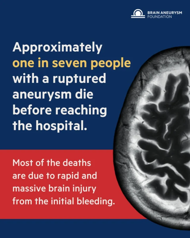 Roughly 15% of people with a ruptured brain aneurysm die before ever reaching the hospital — often due to immediate and severe brain injury from the initial bleed. This is why our mission is urgent. Awareness, early detection, and research can change outcomes.