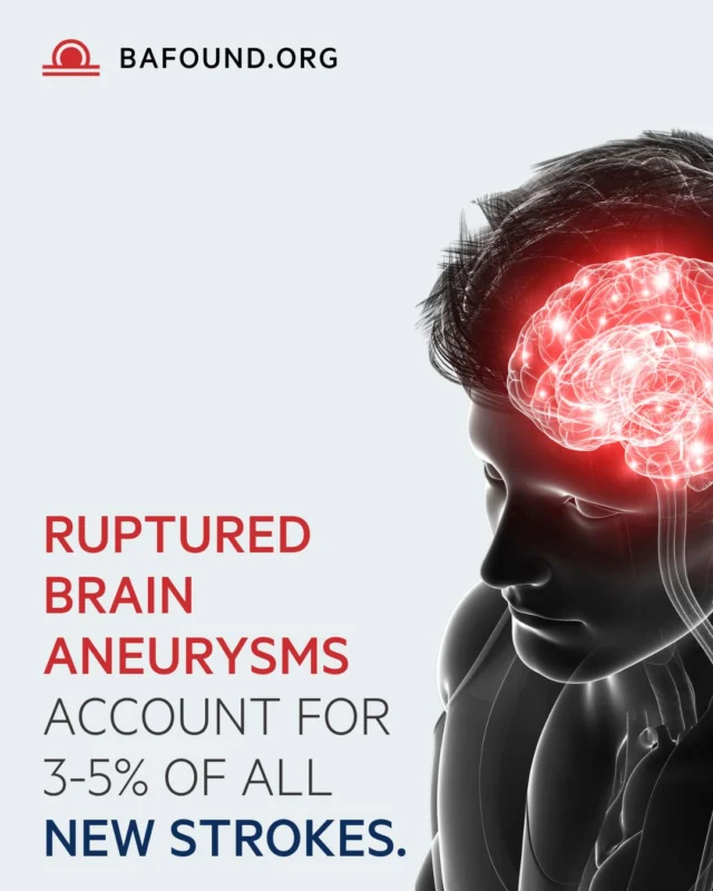 Not all strokes are the same. Ruptured brain aneurysms account for 3–5% of all new strokes. Understanding how strokes and aneurysms differ can help save lives. Learn more: https://www.bafound.org/news/stroke-and-aneurysm-what-is-the-difference/