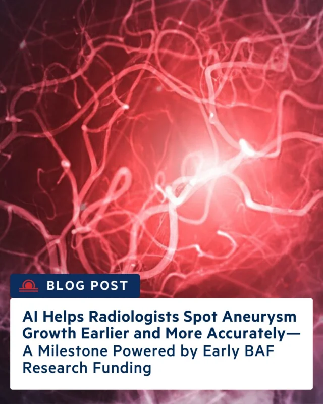 We’re excited to share our latest blog on a major advance in brain aneurysm care: how artificial intelligence is helping radiologists detect aneurysm growth earlier and more accurately. Supported by early Brain Aneurysm Foundation research funding, these AI tools can catch subtle changes that might otherwise be missed — helping guide earlier, potentially life-saving care. Click the link in our bio.