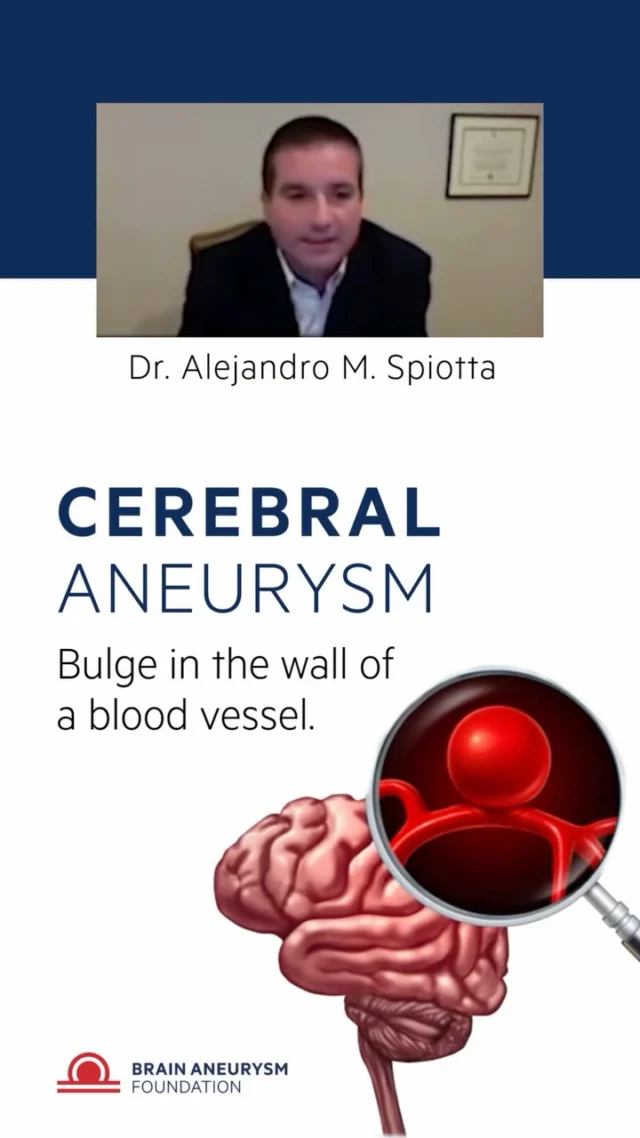 Curious about brain aneurysms? Dr. Spiotta explains what a cerebral aneurysm is, how it forms, and why understanding it matters.
Watch this short to get the key facts in under a minute.
#BrainAneurysmAwareness #MedicalEducation #BrainHealth #CerebralAneurysm #EarlyDetection