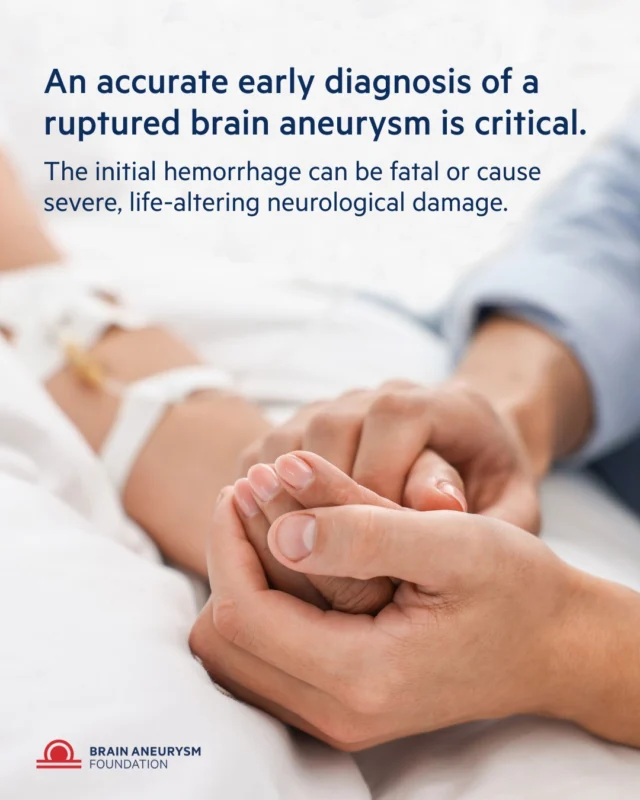 Accurate, early diagnosis of a ruptured brain aneurysm is critical. The first hemorrhage can be fatal or cause severe neurological damage, so recognizing the signs and seeking immediate care can save lives. Learn more and explore statistics at https://www.bafound.org/understanding-brain-aneurysms/statistics-and-facts/