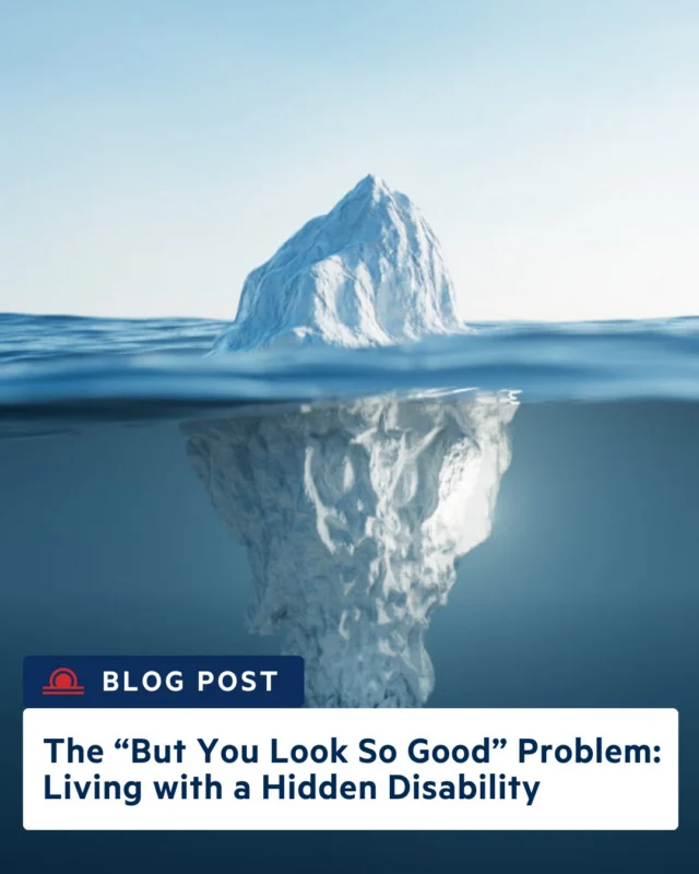 Many brain aneurysm survivors hear, “You’d never even know.” While meant kindly, it can overlook the invisible challenges of recovery—like neuro-fatigue, sensory overload, and the daily effort to keep up. Our latest blog highlights what healing can really look like and why understanding these hidden struggles matters, click the link in bio.