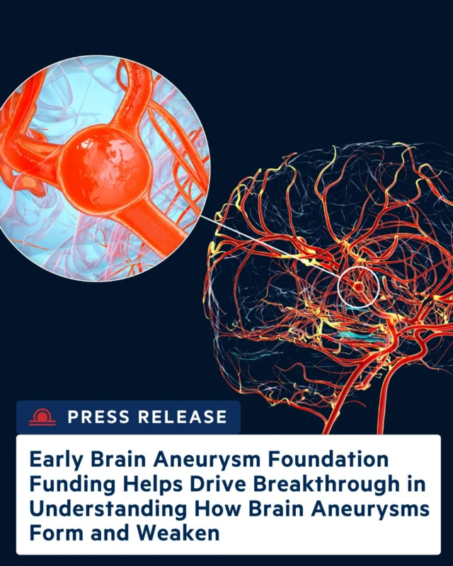 This is what BAF research grants make possible. Dr. Ethan Winkler, a BAF research grant recipient and assistant professor of Neurological Surgery at @UCSF just published a landmark study in @Nature Neuroscience mapping why brain aneurysms rupture at the cellular level. His findings could lead to treatments that prevent ruptures before they happen. Read the full press release from the link in our bio.