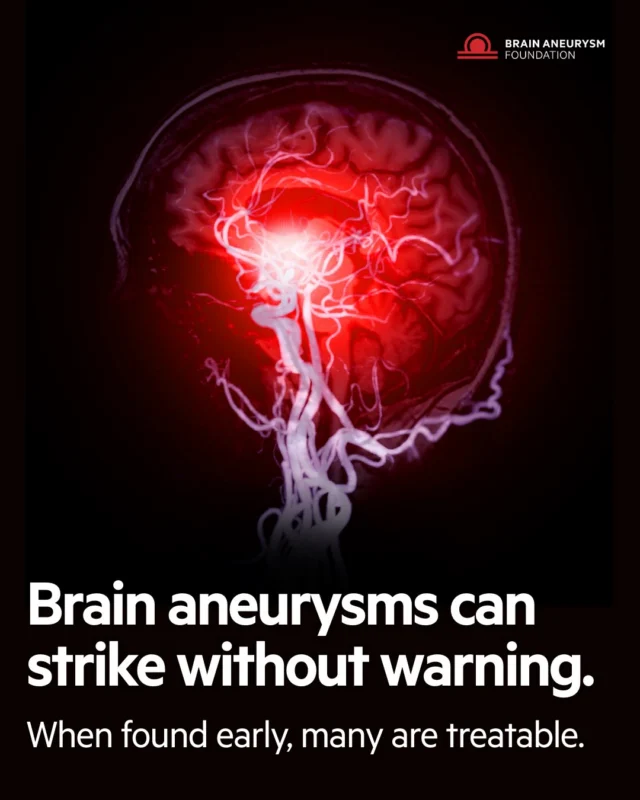 30,000 Americans experience a ruptured brain aneurysm each year — many without any prior warning. When detected early, many are treatable. Early detection starts with awareness.  #BrainAneurysm #EarlyDetection #BrainHealth #BrainAneurysmFoundation