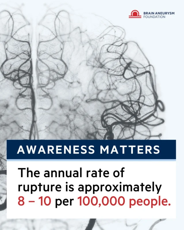 The annual rate of brain aneurysm rupture is approximately 8–10 per 100,000 people. Know the signs, https://www.bafound.org/understanding-brain-aneurysms/warning-signs-symptoms/