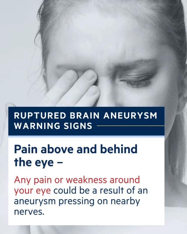 Could you spot the warning signs of a ruptured brain aneurysm? Pain above and behind the eye can mean an aneurysm is pressing on nearby nerves. #KnowTheSigns #BrainAneurysmAwareness